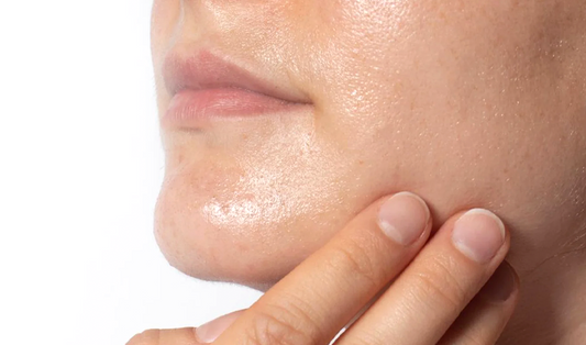 oily skin