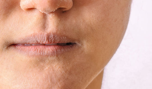 Best Skincare Products To Rejuvenate Dry Skin