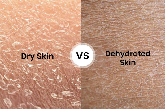 Dry Skin vs Dehydrated Skin