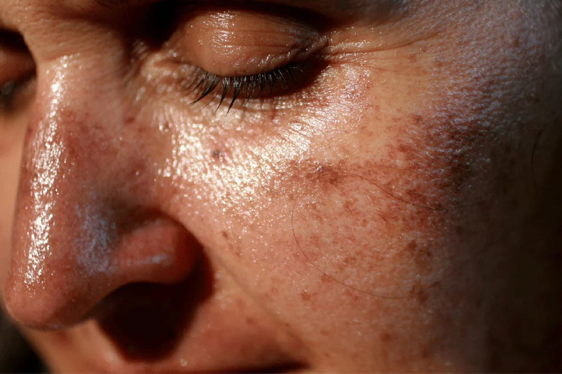 Reverse Sun Damage: 5 Expert-Suggested Ways to Restore Your Skin