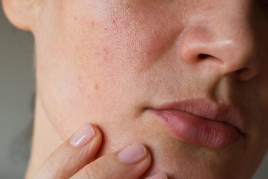 sebum control: Myths Vs facts
