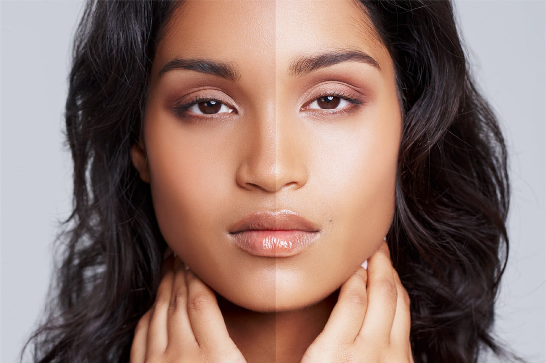 how to remove long-term tanning