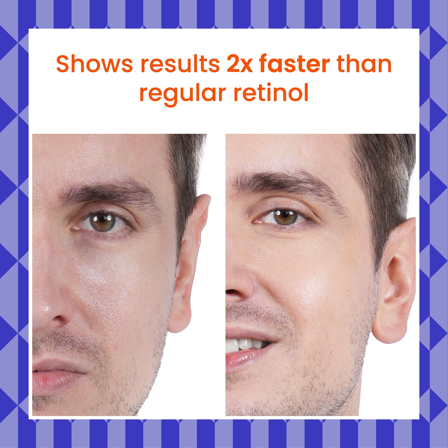 0.15% Retinol Night Serum