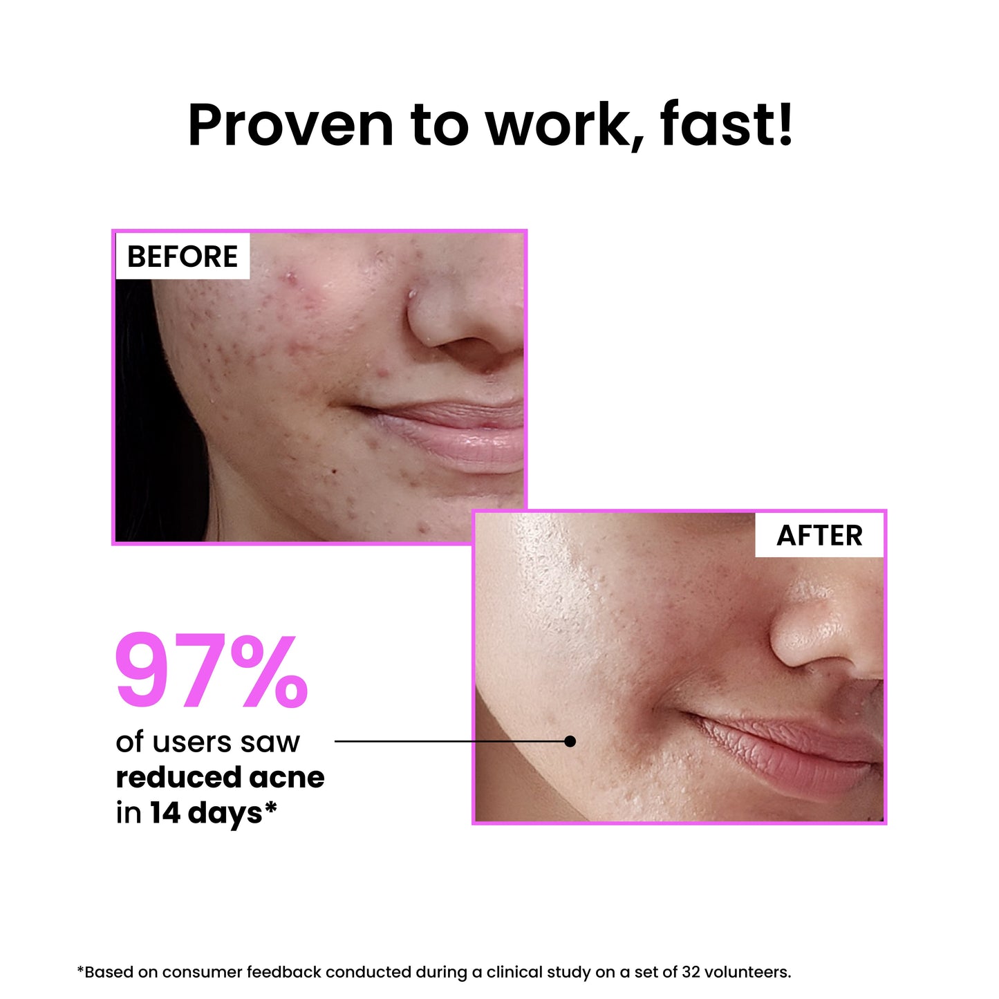 12% Niacinamide Clarifying Serum