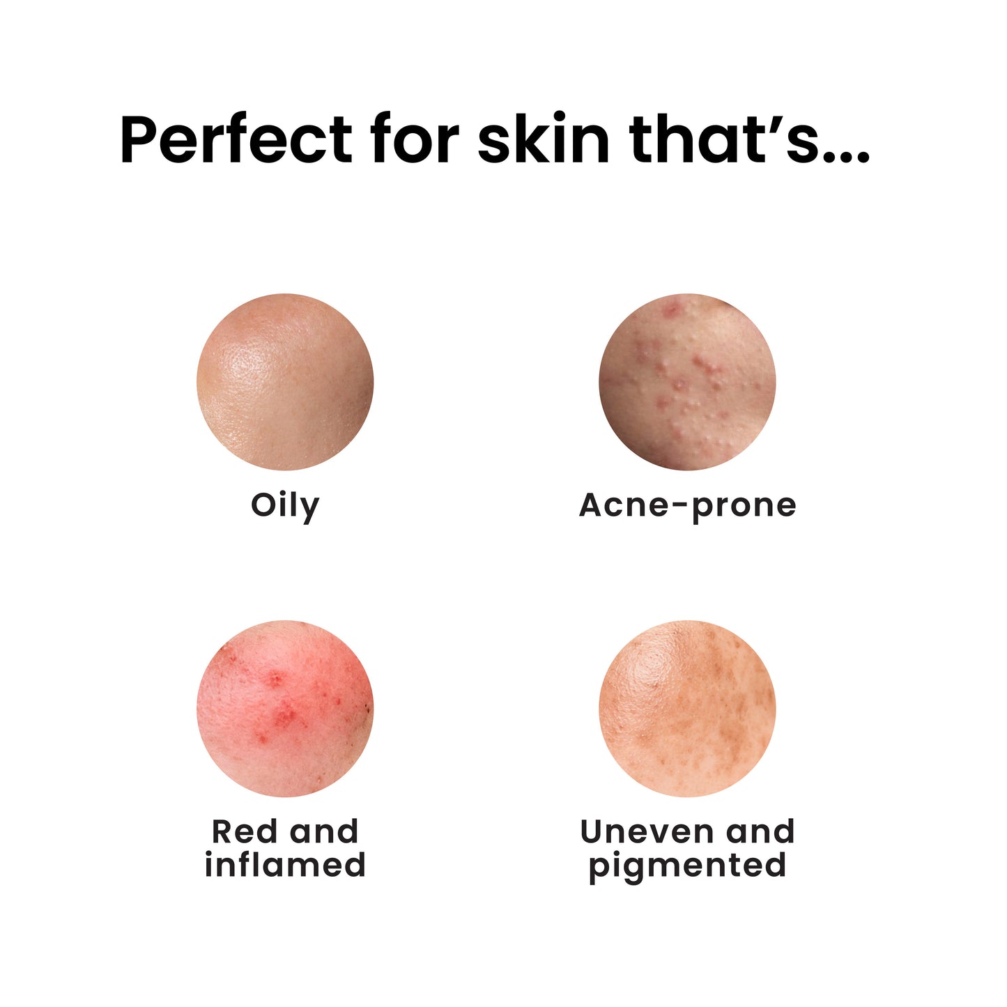 12% Niacinamide Clarifying Serum