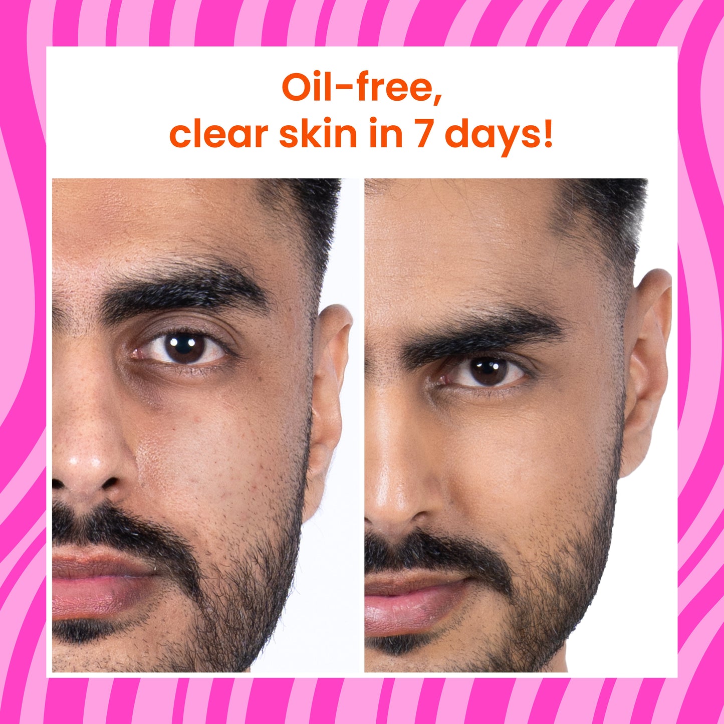 Oil & Acne Control Face Wash