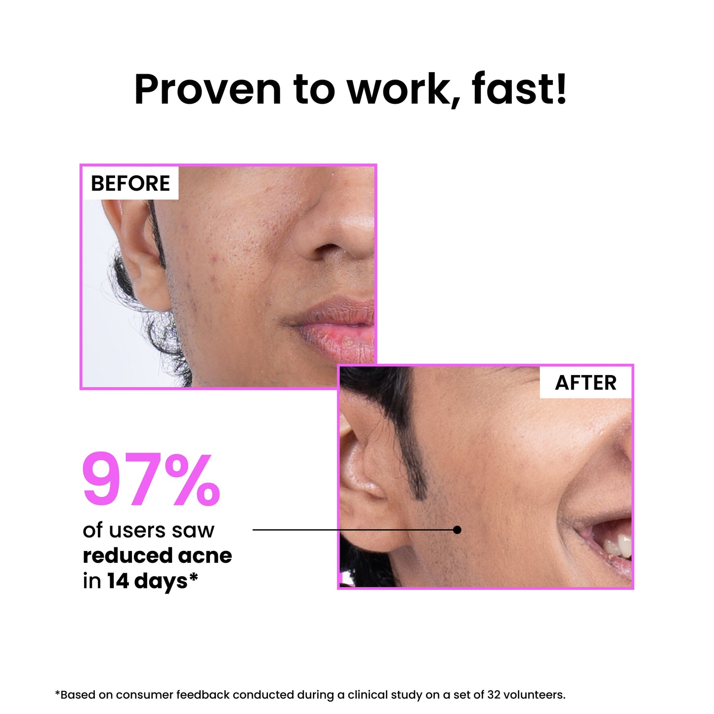 12% Niacinamide Clarifying Serum