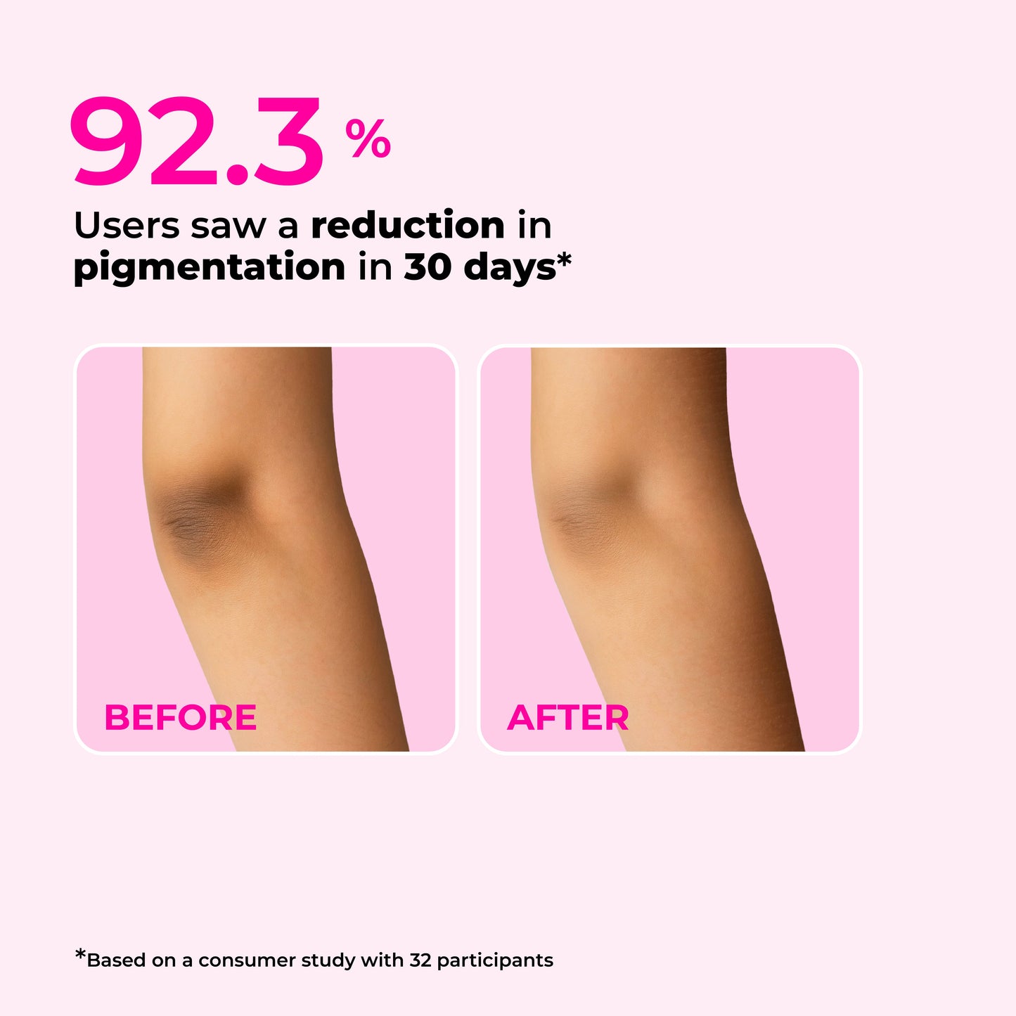 Brightening Body Lotion with Niacinamide & Kojic Acid